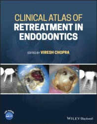 Clinical Atlas of Retreatment in Endodontics - Viresh Chopra (ISBN: 9781119509202)
