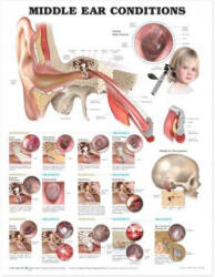 Middle Ear Conditions Anatomical Chart - Anatomical Chart Company (ISBN: 9781605470955)