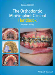Orthodontic Mini-implant Clinical Handbook 2nd Edition - Richard Cousley (ISBN: 9781119509752)