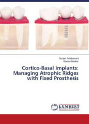 Cortico-Basal Implants - Gunjan Tahilramani, Gaurav Beohar (ISBN: 9786203580983)