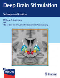 Deep Brain Stimulation: Techniques and Practices (ISBN: 9781626237971)