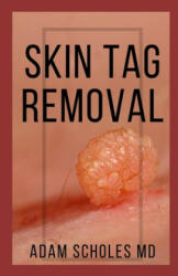 Skin Tag Removal: All You Need To Know About Methods of removing Mole, Wart and Skin Tag Naturally - Adam Scholes MD (ISBN: 9781658527903)