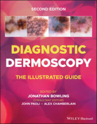 Diagnostic Dermoscopy - The Illustrated Guide, 2e - Jonathan Bowling (ISBN: 9781118930489)