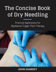 Concise Book of Dry Needling - John Sharkey (ISBN: 9781623170837)