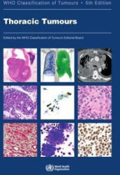 Thoracic Tumours: Who Classification of Tumours (ISBN: 9789283245063)