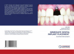 Immediate Dental Implant Placement - AMIT MANI (ISBN: 9786203202847)