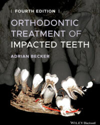 Orthodontic Treatment of Impacted Teeth - Adrian Becker (ISBN: 9781119565376)