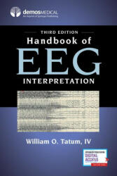 Handbook of Eeg Interpretation (ISBN: 9780826147080)