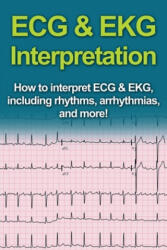 ECG & EKG Interpretation (ISBN: 9781761030987)
