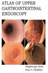 Atlas of Upper Gastrointestinal Endoscopy - Jesse Abiodun Otegbayo, Dennis a. Ndububa, Adegboyega Akere (ISBN: 9781974166503)