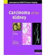 Carcinoma of the Kidney - Uday Patel (ISBN: 9780521878388)