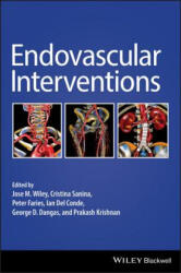 Endovascular Interventions - JOSE WILEY (ISBN: 9781119283492)