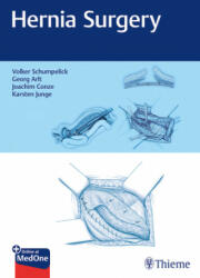 Hernia Surgery - Volker Schumpelick, Georg Arlt, Klaus Joachim Conze, Karsten Junge (ISBN: 9783132405516)
