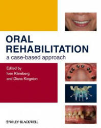 Oral Rehabilitation - A Case-Based Approach - Iven Klineberg (ISBN: 9781405197816)
