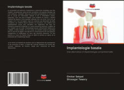 Implantologie basale - Shivsagar Tewary (ISBN: 9786202981729)