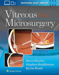 Vitreous Microsurgery (ISBN: 9781975168353)