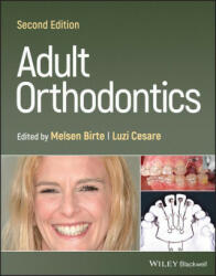 Adult Orthodontics 2nd Edition (ISBN: 9781119775775)