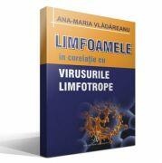 LIMFOAMELE SI VIRUSURILE LIMFOTROPE - Ana Maria Vladareanu (ISBN: 9789731620060)