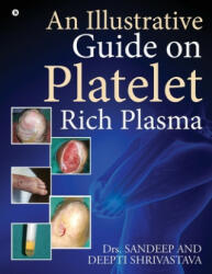 Illustrative Guide on Platelet Rich Plasma - Dr Deepti Shrivastava (ISBN: 9781646786114)