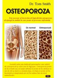 Osteoporoza - Dr. Tom Smith (ISBN: 9789736364051)