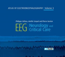Atlas of Electroencephalography Volume 3 - PHILIPPE GELISSE (ISBN: 9782742015795)