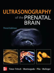 Ultrasonography of the Prenatal Brain, Third Edition - Ilan Timor-Tritsch (ISBN: 9780071613064)