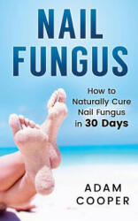 Nail Fungus: How to Naturally Cure Nail Fungus in 30 Days: Natural remedies, homeopathy for toenail fungus - Adam Cooper (ISBN: 9781539416098)