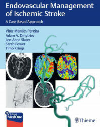 Endovascular Management of Ischemic Stroke - Lee-Ann Slater, Sarah Power, Timo Krings (ISBN: 9781626232754)