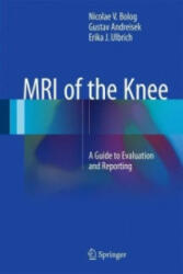 MRI of the Knee - Nicolae Bolog, Gustav Andreisek (ISBN: 9783319081649)