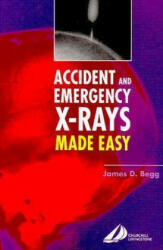 Accident and Emergency X-Rays Made Easy - James Begg (2008)