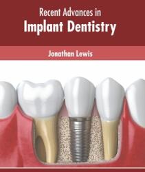 Recent Advances in Implant Dentistry (ISBN: 9781639874767)