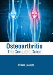Osteoarthritis: The Complete Guide (ISBN: 9781639274024)