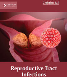 Reproductive Tract Infections (ISBN: 9781639272327)