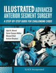 Illustrated Advanced Anterior Segment Surgery - I. Ahmed (ISBN: 9781630911843)