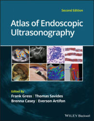 Atlas of Endoscopic Ultrasonography (ISBN: 9781119523000)