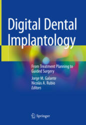 Digital Dental Implantology: From Treatment Planning to Guided Surgery (ISBN: 9783030659462)