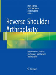 Reverse Shoulder Arthroplasty - Mark Frankle, Scott Marberry, Derek Pupello (ISBN: 9783319371535)