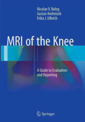 MRI of the Knee - Nicolae V. Bolog, Gustav Andreisek, Erika J. Ulbrich (ISBN: 9783319352534)
