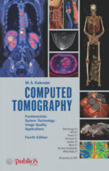 Computed Tomography - Willi A. Kalender (ISBN: 9783895784712)