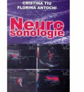 Neurosonologie - Cristina Tiu, Florina Antochi (ISBN: 9789736243752)