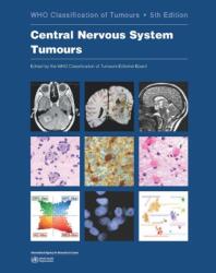 Central Nervous System Tumours: Who Classification of Tumours (ISBN: 9789283245087)