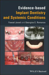 Evidence-based Implant Dentistry and Systemic Conditions - Fawad Javed, Georgios Romanos (ISBN: 9781119212249)
