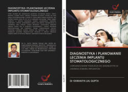 Diagnostyka I Planowanie Leczenia Implantu Stomatologicznego - DR KANHAI LAL GUPTA (ISBN: 9786202851862)