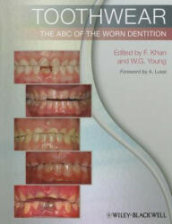 Toothwear - The ABC of the Worn Dentition - Farid Khan (ISBN: 9781444336559)