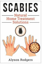 Scabies Natural Home Treatment Solution - Alyson Rodgers (ISBN: 9781495405105)