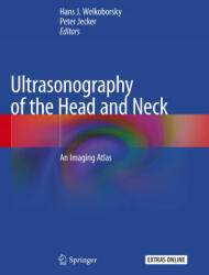 Ultrasonography of the Head and Neck: An Imaging Atlas - Hans J. Welkoborsky, Peter Jecker (ISBN: 9783030126438)