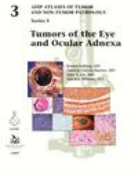 Tumors of the Eye and Ocular Adnexa - Robert Folberg, Patricia Chevez-Barrios, Amy Y. Lin, Tatyana Millman (ISBN: 9781933477923)