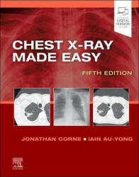 Chest X-Ray Made Easy - JONATHAN CORNE (ISBN: 9780702082344)