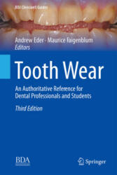 Tooth Wear: An Authoritative Reference for Dental Professionals and Students (ISBN: 9783030861094)