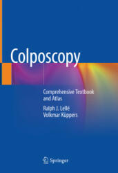 Colposcopy: Comprehensive Textbook and Atlas - Ralph J. Lellé, Volkmar Küppers (ISBN: 9783030853860)